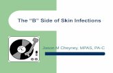 The “B” side of Infections - Skin Bones CME