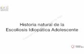 UD5a-Historia Natural de la escoliosis copia