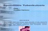 Spondilitis TB (Ok)