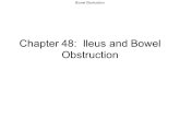 Bowel Obstruction Chapter 48: Ileus and Bowel Obstruction