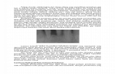 Tulang Alveolar Adalah Bagian Dari Tulang Rahang Yang Mengililingi Permukaan Gigi Baik Di Maksila Ataupun Mandibula