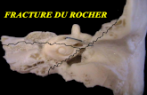 Fracture du rocher