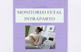 Monitoreo Electr³nico Fetal Intraparto
