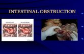 Intestinal Obstruction New