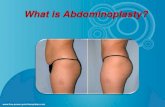 What is Abdominoplasty?