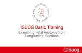 ISUOG Basic Training Training 1. Fetal head and heartbeat visible on first longitudinal plane 2. You can exclude anencephaly and encephalocele 3. With the sagittal plane you can