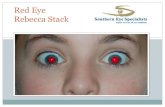 Red Eye Rebecca Stack - GP South/Sat_Room6_1630_Stack_red eye...  No red eye and looking for reflexes