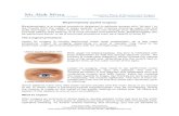 Blepharoplasty (eyelid surgery) The surgical .2017-08-02  Blepharoplasty (eyelid surgery) Blepharoplasty