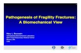 Pathogenesis of Fragility Fractures: A Biomechanical View .1 Pathogenesis of Fragility Fractures:
