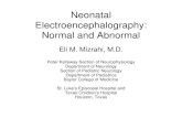 Neonatal Electroencephalography: Normal and Abnormal .Neonatal Electroencephalography: Normal and