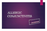 Allergic conjuncticitis