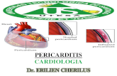 Pericarditis - Cardiologia