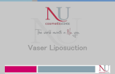 Vaser liposuction