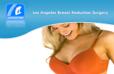 Breast Implant & Reduction Surgery - Breast Reduction Surgery Los Angeles