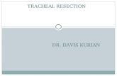 Tracheal resection - anesthesia