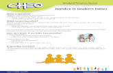 Jaundice in newborn babies - CHEO - Resources/Jaundice in newborn bab  Jaundice in newborn babies