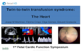 Twin-to-twin transfusion syndrome: The .Twin-to-twin transfusion syndrome: The Heart ... Congenital
