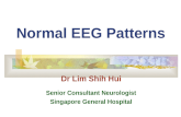 Normal EEG Patterns Dr Lim Shih Hui Senior Consultant Neurologist Singapore General Hospital
