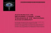 ADVANCES IN WOUND CARE: THE TRIANGLE OF WOUND WOC Nurse Clinician, ... ¢â‚¬â€œ Periwound skin: oedema, haemosiderosis,