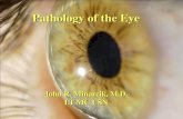 Pathology of the Eye ¢â‚¬¢Conjunctival intraepithelial neoplasia (CIN) ¢â‚¬¢Squamous Cell ¢â‚¬¢Melanoma ¢â‚¬¢Lymphoid