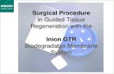 in Guided Tissue Regeneration with Periodontal Defect Regeneration In a guided tissue regeneration procedure
