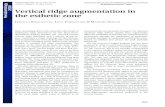 Vertical ridge augmentation in the esthetic zone esthetic objectives for implant therapy from a surgical