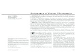 Sonography of Plantar Fibromatosis - Semantic Scholar Sonography of Plantar Fibromatosis OBJECTIVE