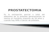 Prostatectomia 20152