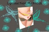Liposuction Methods
