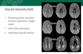 Vascular Dementia (VaD) Processing speed, executive function impairment, insight, mood Multi-infarct dementia Subcortical vascular disease