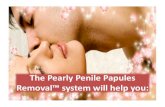 Pearly Penile Papules Removal at Home
