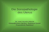 Die Sonopathologie des Uterus Dr. med. Kerstin Ulbicht Elblandkliniken Meien- Radebeul GmbH Frauenklinik Radebeul