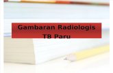 Gambaran Radiologis TB Paru