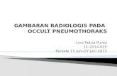Gambaran Radiologis Pada occult pneumotoraks