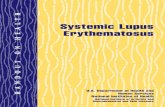 Systemic Lupus Erythematosus - There are several kinds of lupus:: Systemic lupus erythematosus (SLE)