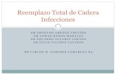 Reemplazo Total de Cadera Infecciones - Reemplazo Total de Cadera Infecciones. Infecciones en RTC Generalidades