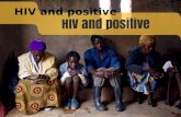 2173378 HIV and Positive
