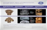 Sonographic Signs of Adenomyosis 2020. 9. 27.¢  Sonographic Signs of Adenomyosis Benefits of the Coronal