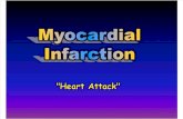 Myocardial Infarction Report