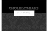 CHOLELITHIASIS [Autosaved]
