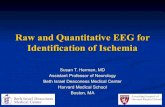 Raw and Quantitative EEG for Identification of Ischemiacapitulo-cubano-nfc. 2019. 10. 2.آ  Labar: EEG