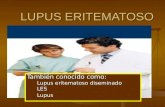 LUPUS ERITEMATOSO Tambi©n conocido como: Lupus eritematoso diseminado Lupus eritematoso diseminado LES LES Lupus Lupus