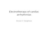 Electrotherapy of Cardiac Arrhythmias