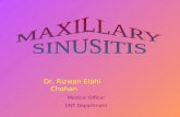 Maxillary sinusitis