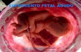 Sufrimiento Fetal Agudo Intraparto
