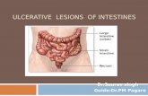 Ulcerative  intestine