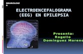 Electroencefalograma (eeg) en epilepsia