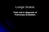 Pulmonary embolism and lung scans