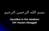 ¨³… §„„‡ §„±­…† §„±­… Jaundice in the newborn DR Husain Alsaggaf