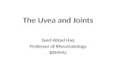 Uvea and joints ophthalmologists